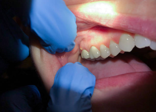 Best Walk-In Emergency Dentist in Shark River Hills, NJ